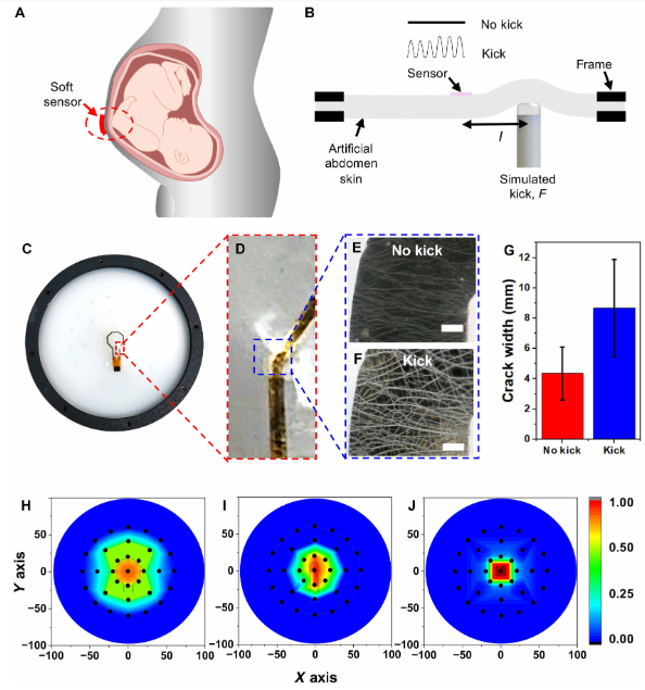 创可贴式传感系统：智能胎动监测新技术详解