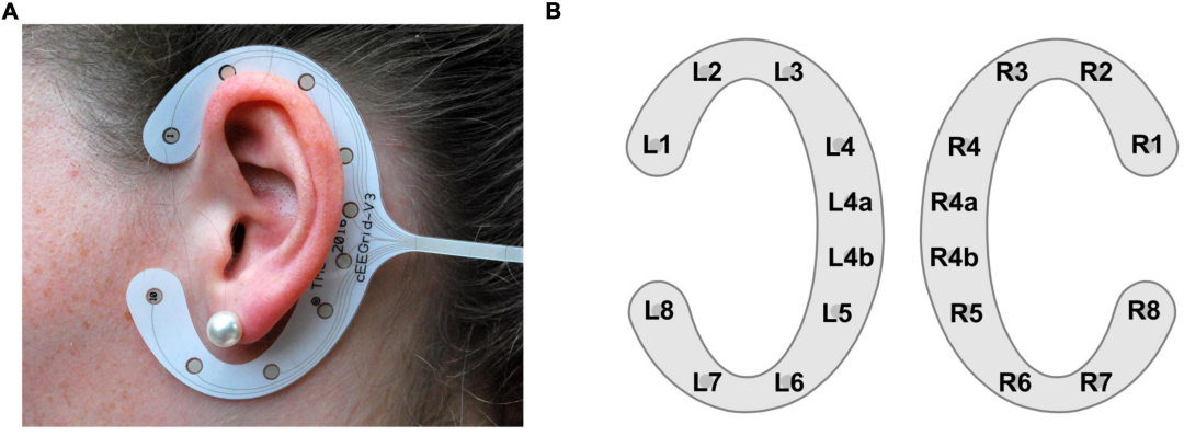耳周脑电监测听觉注意力：语音包络跟踪与频谱熵详解